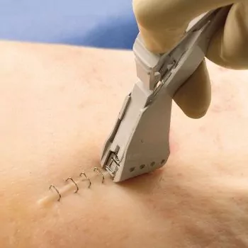 Grapadora cutánea con uso único 3M Precise