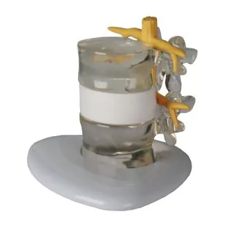 Modelo de simulación de hernia discal 4400 Erler Zimmer