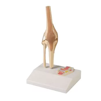 Articulación miniatura de la rodilla con corte transversal Erler Zimmer