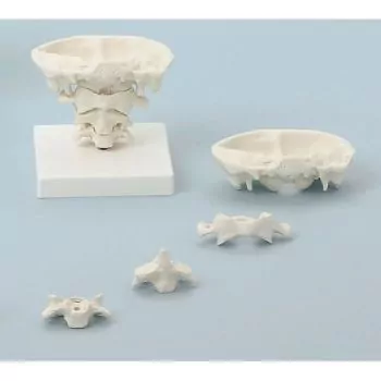 Articulaciones de cabeza con zocalete amovible Erler Zimmer