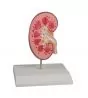 Modelo de cálculo renal, tamaño natural Erler Zimmer