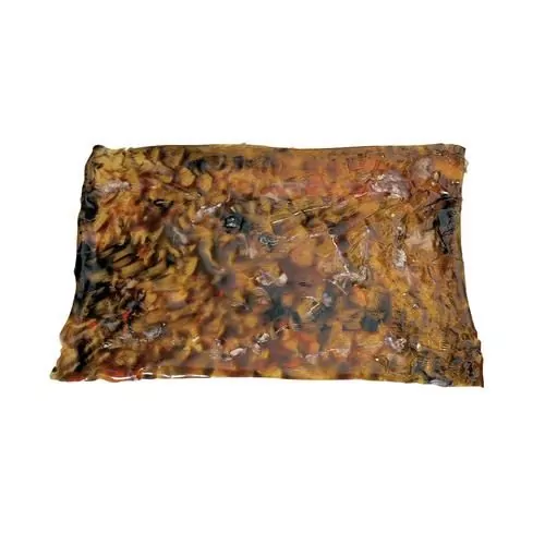 Rollo quemadura individual simulada - Tercer grado 3B Scientific W44796-3