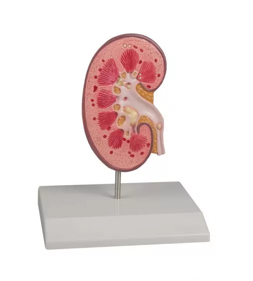 Modelo de cálculo renal, tamaño natural Erler Zimmer